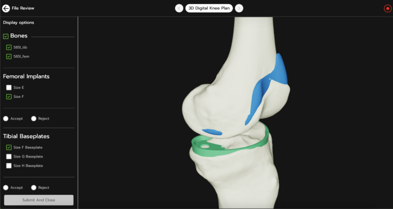 A screenshot of 3D Systems' VSP Connect surgical case portal.